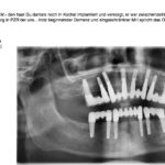 zahnmedizin, patient, implantat, kosten